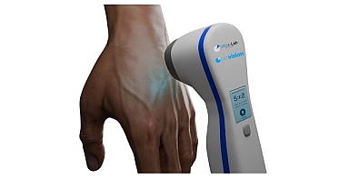 Üniversite öğrencisi babasının hastalığından yola çıkarak vitiligo tedavisi için cihaz geliştirdi